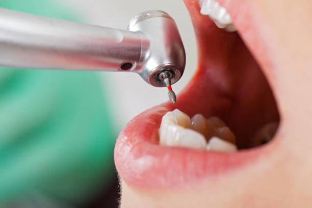 Best Same-Day Emergency Dentist in Huntington, VA